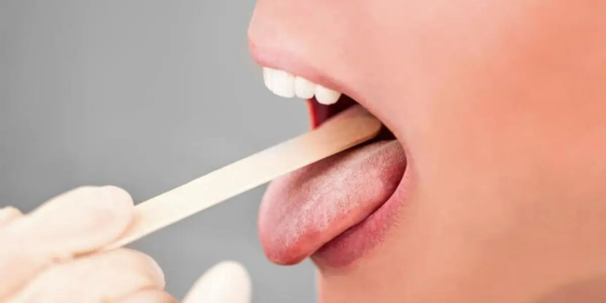 Factors That Can Cause Your Mouth Burn