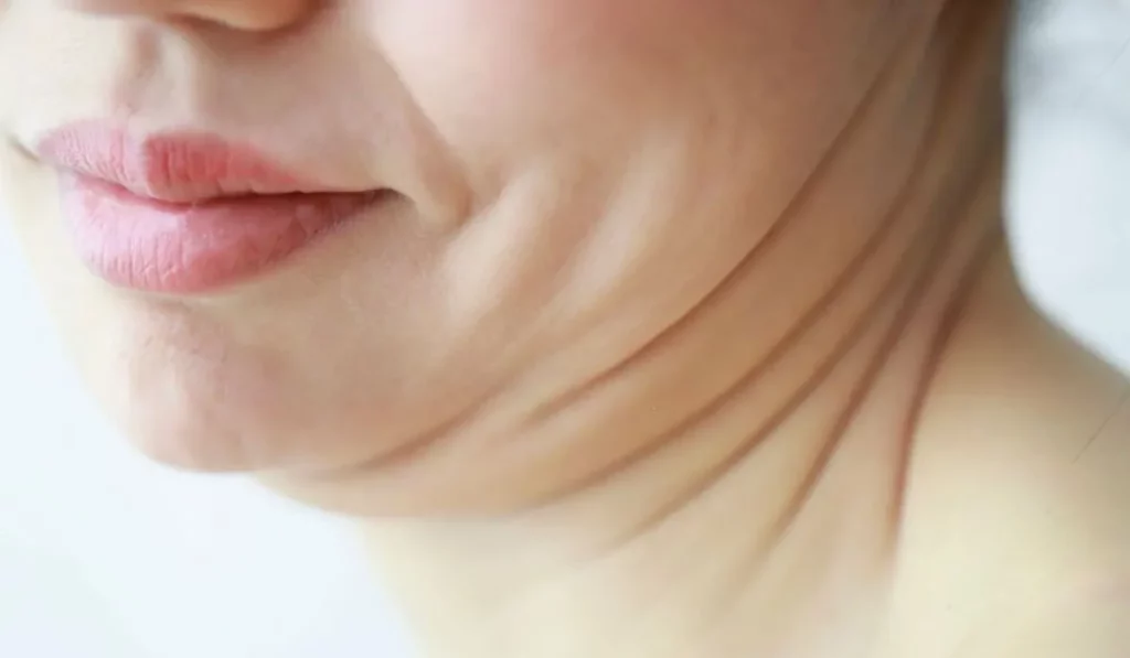 7 Proven Ways To Get Rid Of Neck Fat Quickly