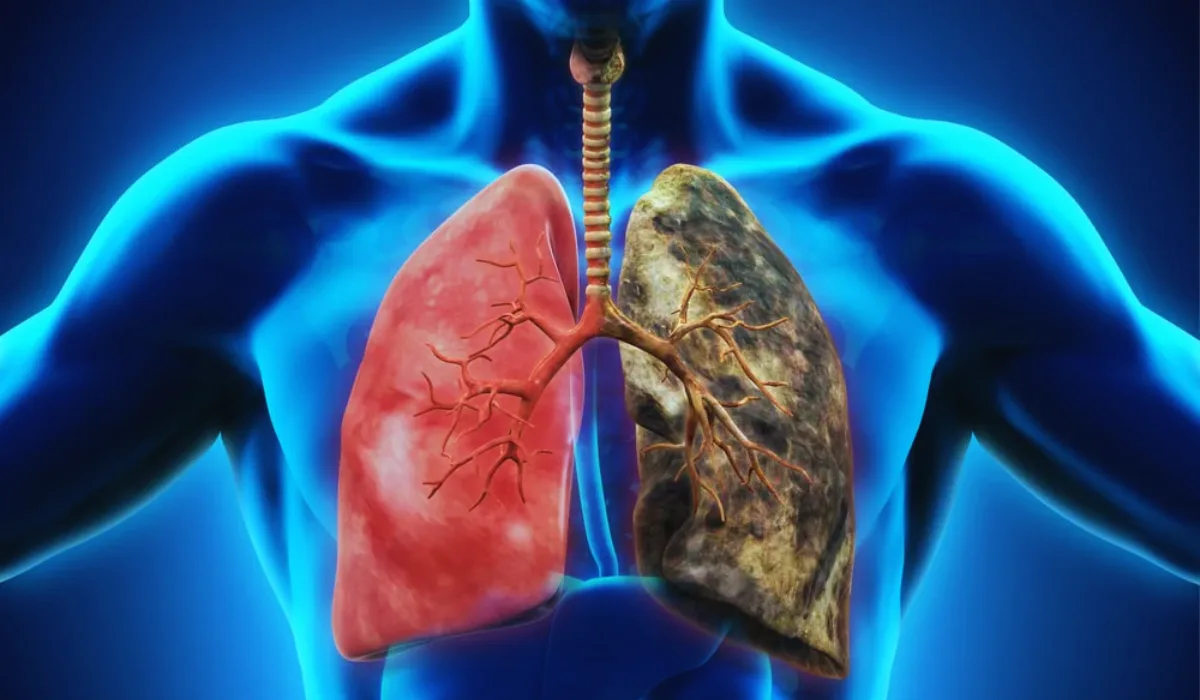 How Do I Improve My Lung Health