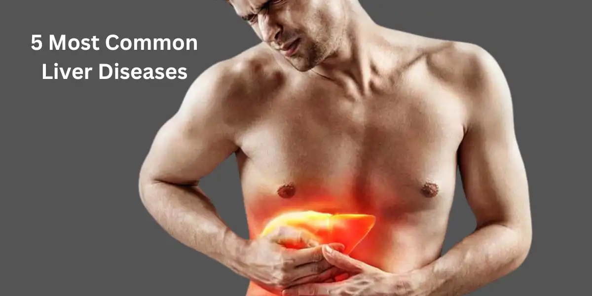 Most Common Liver Diseases