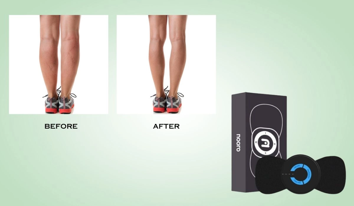 Nooro Whole Body Massager Before And After
