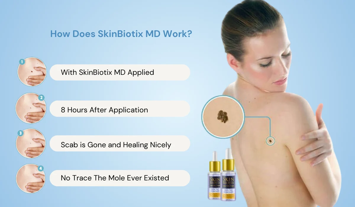 SkinBiotix MD Skin Tag Remover Working