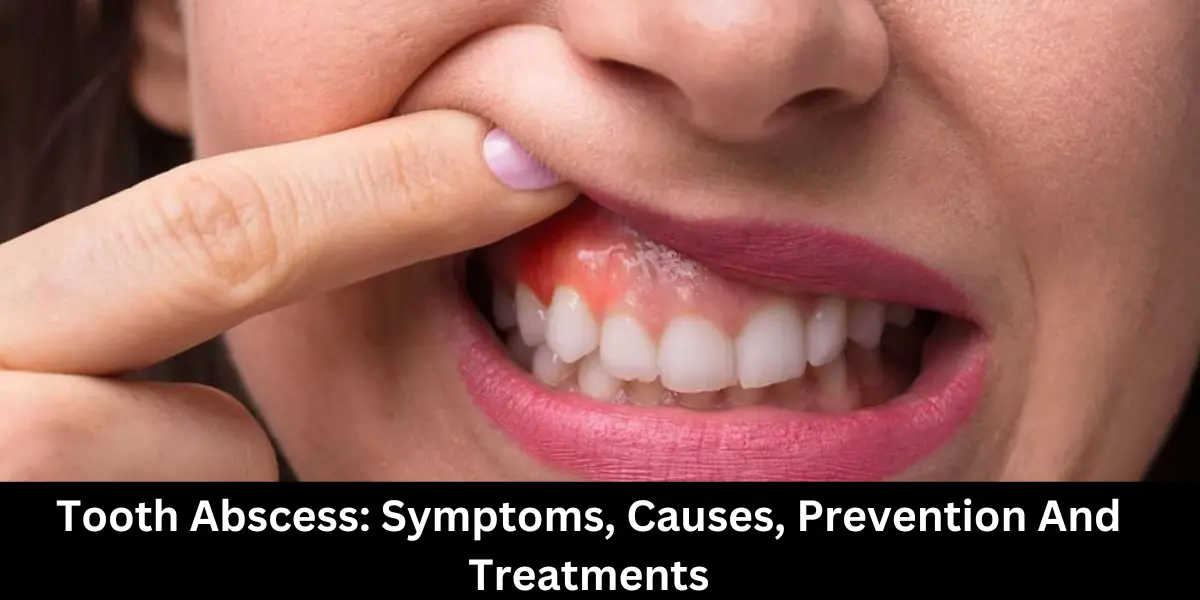 Treat Tooth Root Infection 