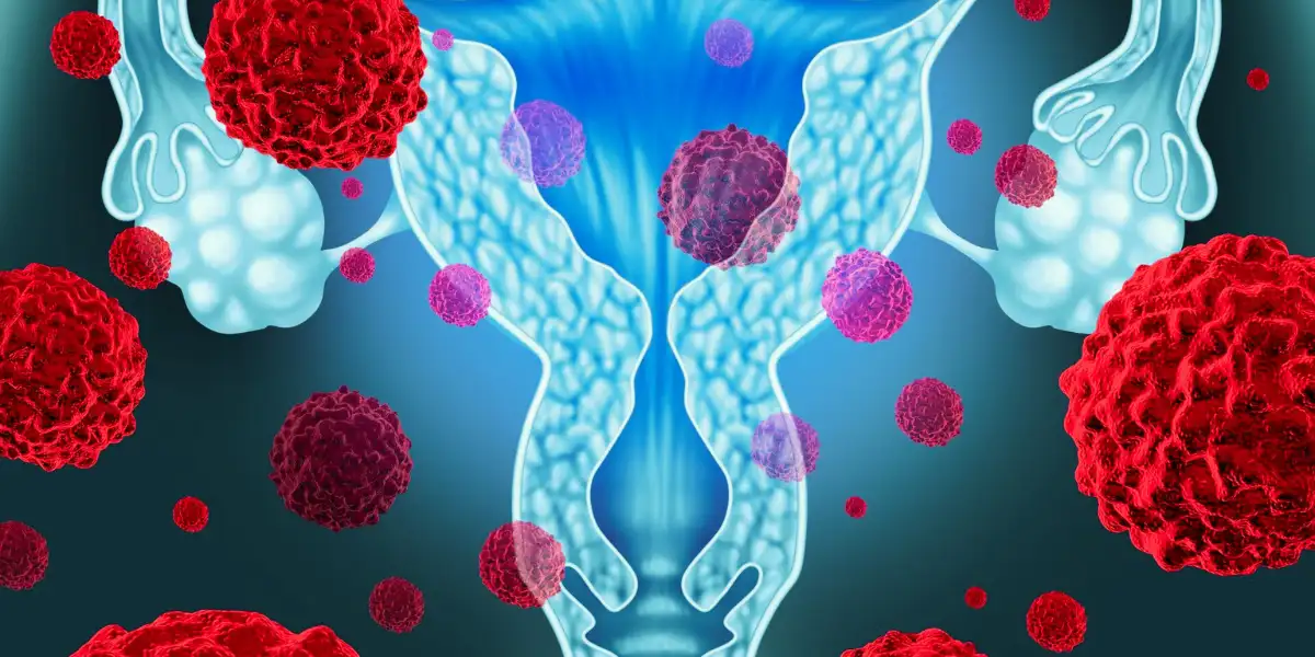 Fibroid Cancer Symptoms