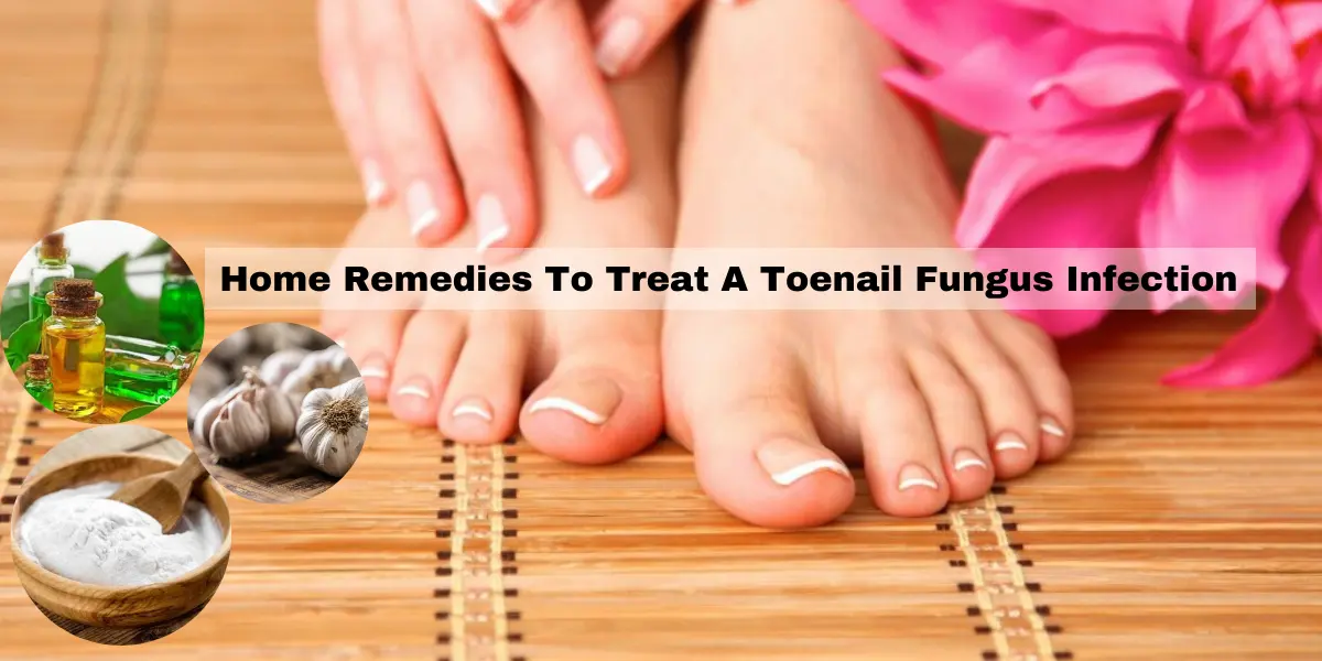 Remedies To Treat A Toenail Fungus Infection