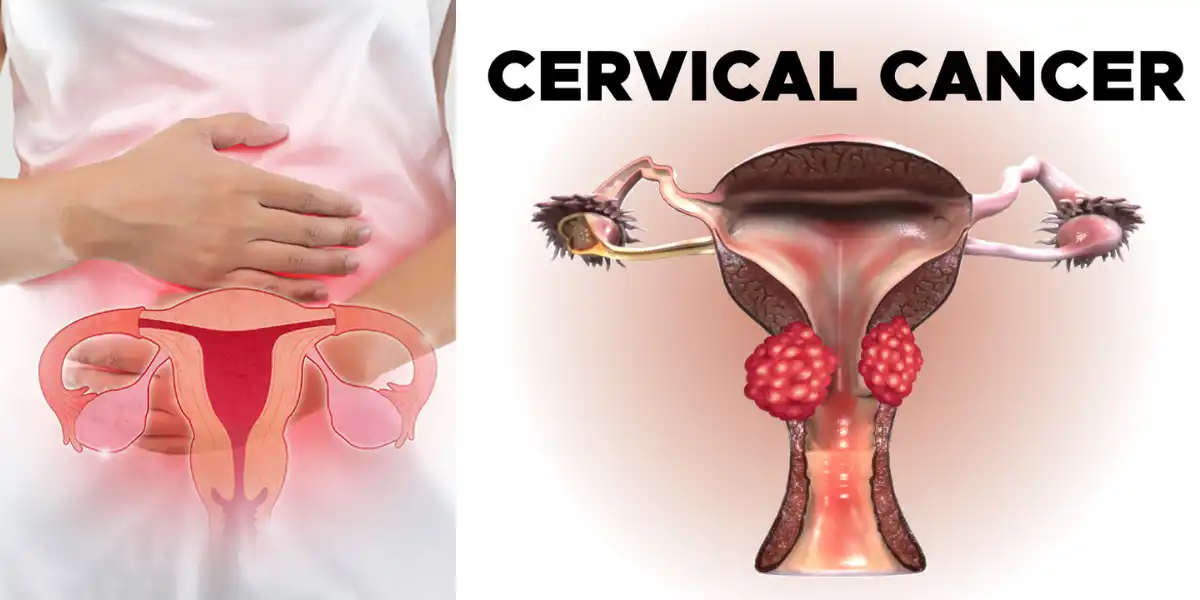 visible signs of cervical cancer
