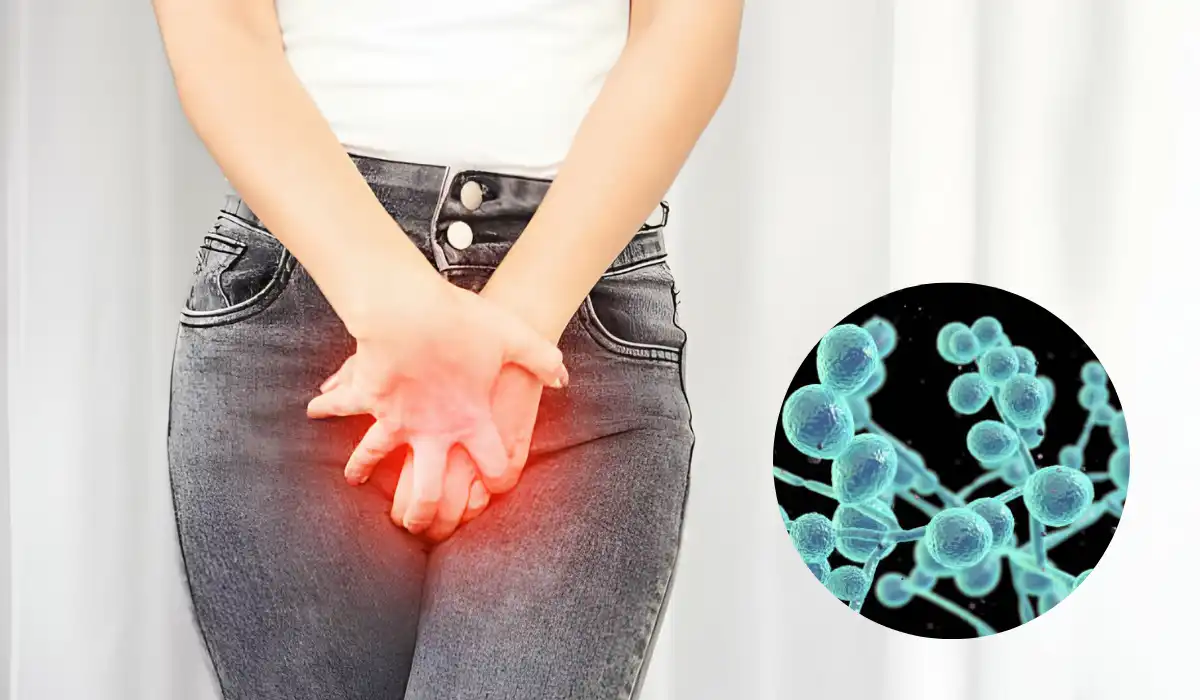 Yeast Infection After Periods